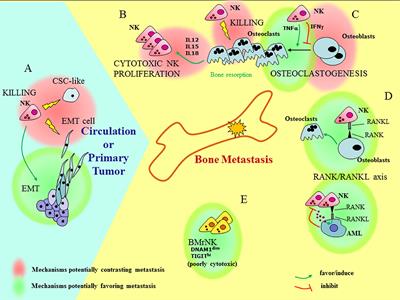 The Uncovered Role of Immune Cells and NK Cells in the Regulation of Bone Metastasis